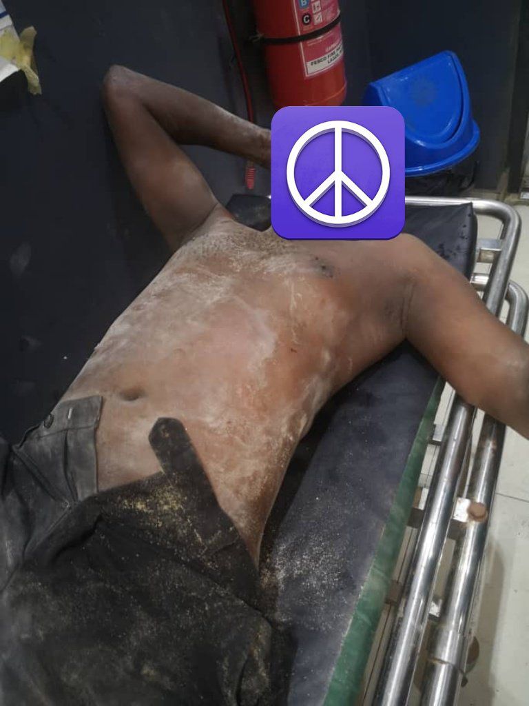 Tension as Lagos building collapses, residents hospitalised <br>