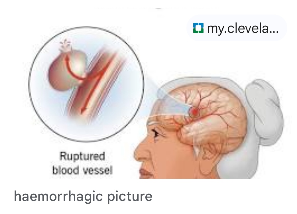 Suspected viral haemorrhagic fever patient tested negative, says Abuja hospital